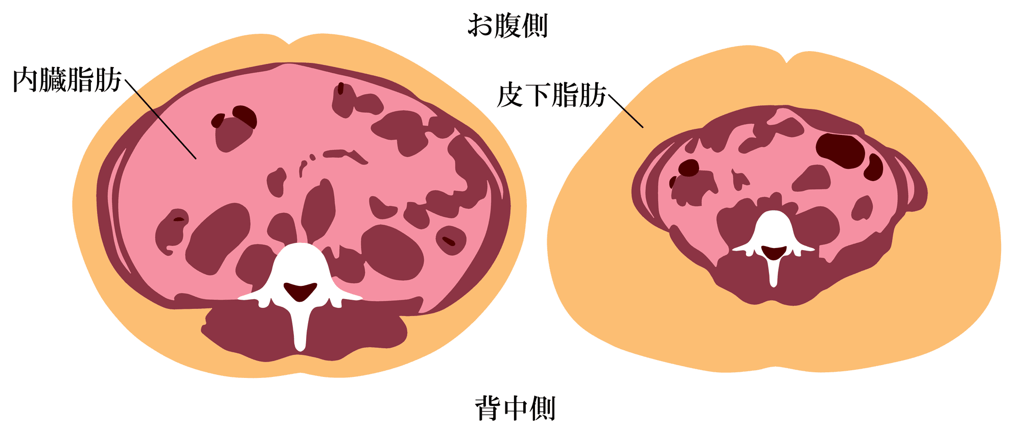 内臓脂肪型肥満と皮下脂肪型肥満の脂肪の付き方の違いのイラスト。内臓脂肪は、胃や腸など、消化器のほとんどが収まるお腹内部の空洞「腹腔（ふくくう）」内につく脂肪の総称。