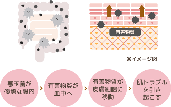 便秘と肌荒れの因果関係のイラストイメージ図