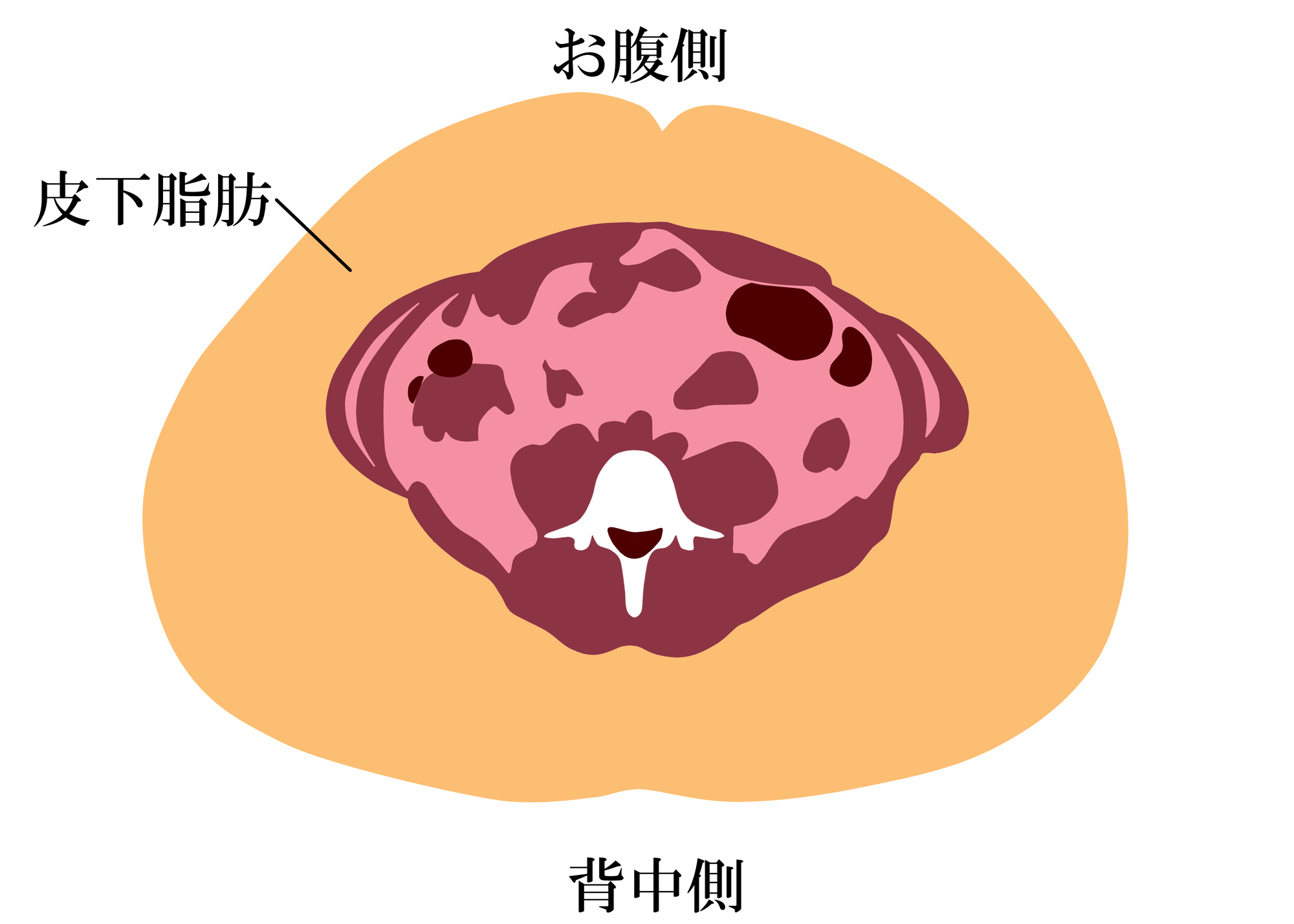 皮下脂肪とは。皮膚の下にある皮下組織につく脂肪のこと。皮下脂肪のイメージ図