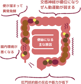 便秘になる主な原因の図