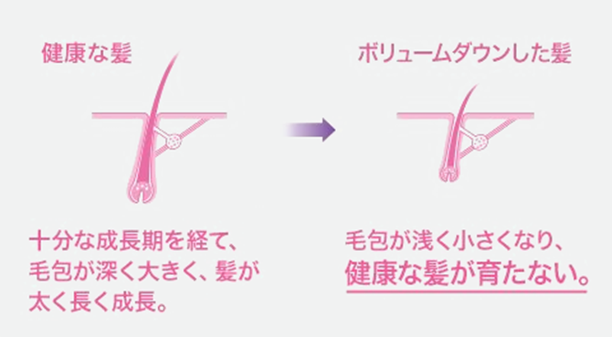 健康な髪とボリュームダウンした髪