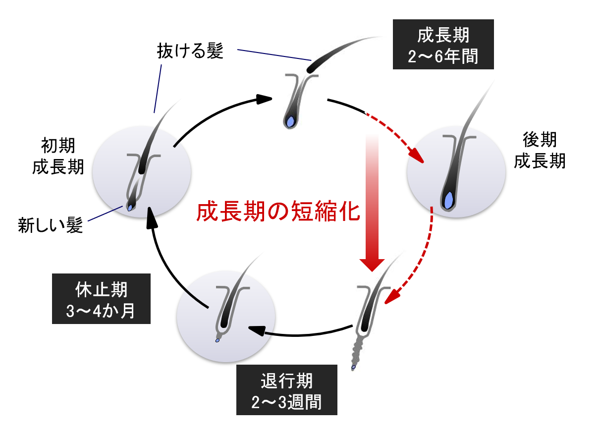 壮年性脱毛症のヘアサイクル