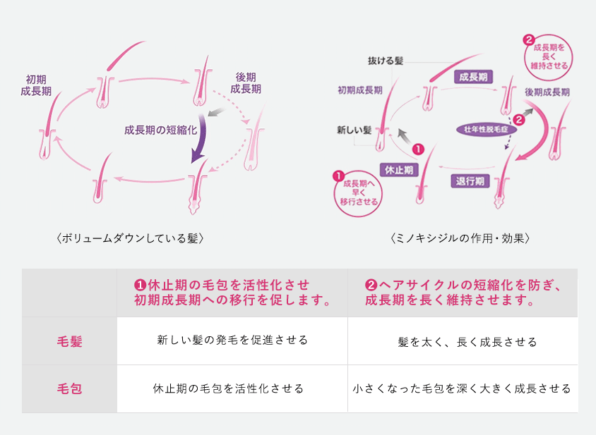 ボリュームダウンしている髪のヘアサイクルは、成長期の短縮化が起こっています。ミノキシジルは、ヘアサイクルのうち、髪の成長が止まる「休止期」の毛包に直接作用して、休止期の毛包を活性化させて成長期への移行を促し、新しい髪の発毛を促進します。また、小さくなった毛包を深く、大きく成長させることで、成長期の髪を太く、長く成長させます。ヘアサイクルの短縮化を防いで、成長期を長く維持させることで、抜け毛の進行を予防します。