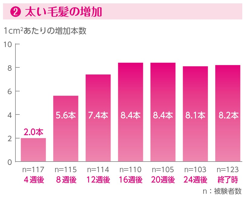 発毛効果に関する臨床試験結果のグラフ。女性用リアップ（ミノキシジル１％製剤、先発品「リアップレディ」）は、6ヵ月使用後において、太い毛髪の増加がみられました。