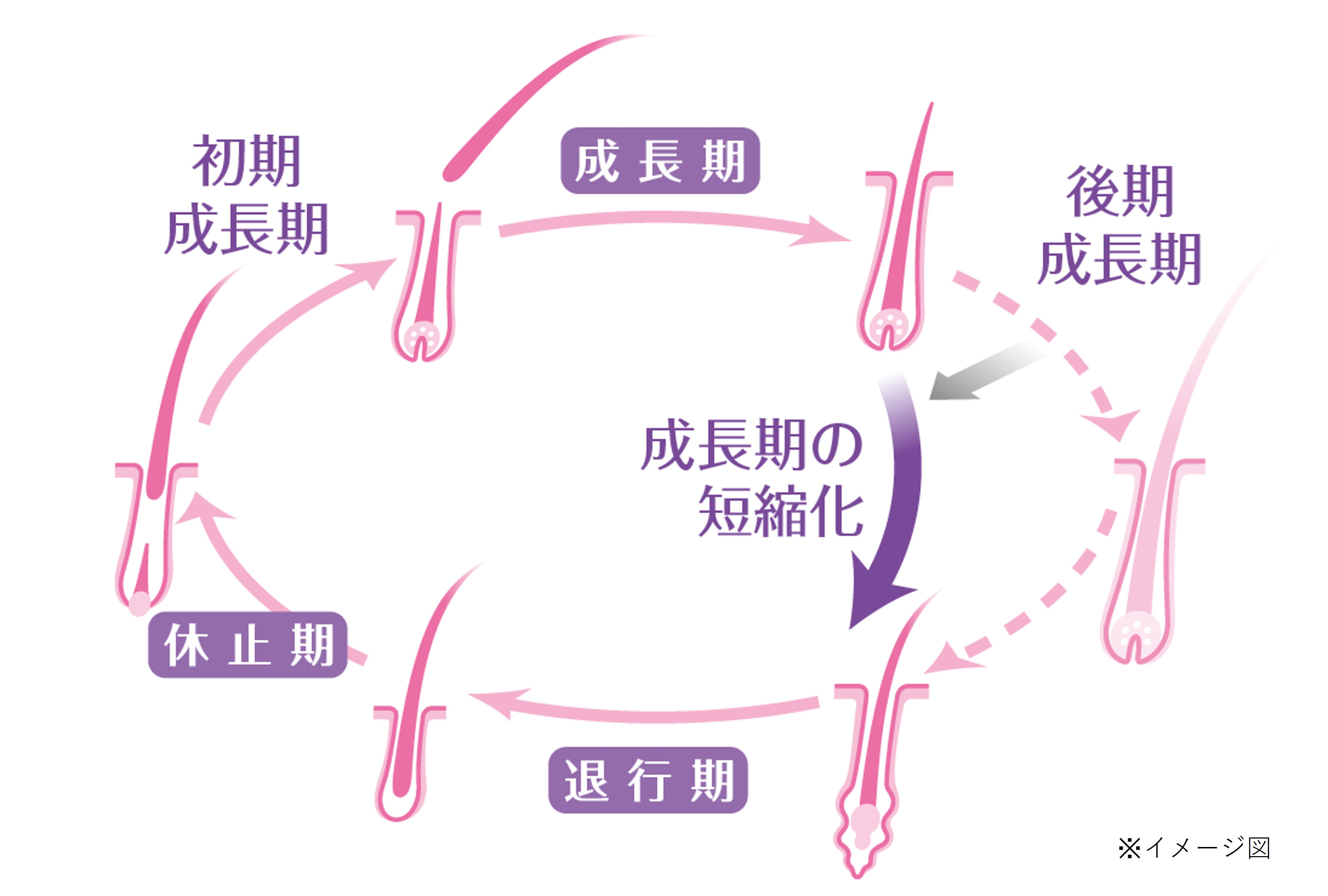 成長期が短縮化した壮年性脱喪章のヘアサイクルの図