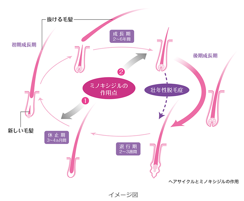 ヘアサイクルとミノキシジルの作用点（成長期と休止期）のイメージ図。