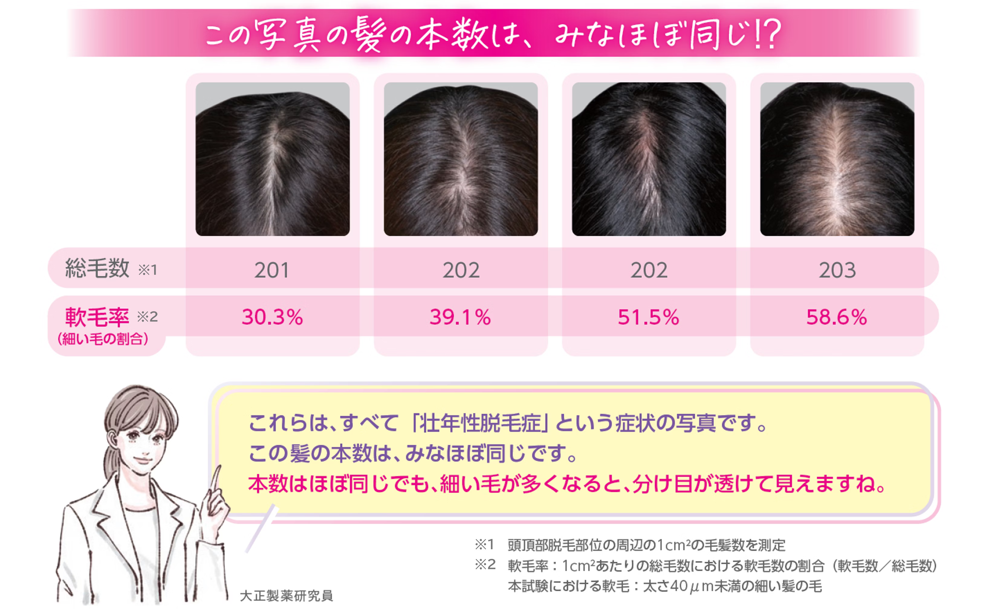 4枚の分け目の写真は、総毛数がほぼ同じだが、軟毛率が30.3％、39.1％、51.5％、58.6％となっており、細い毛が多くなるほど、分け目が透けて見える。