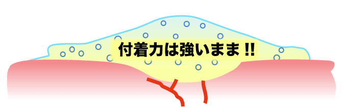 アクアセンサーバリア®技術により、すぐれた付着力を発揮し、口内炎の患部を覆って保護し、刺激からブロックします。