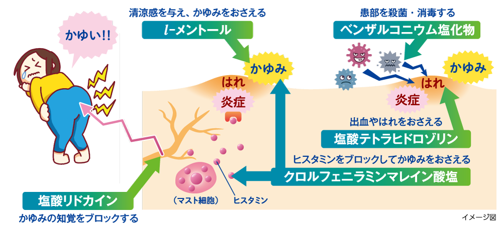 ５つの有効成分が痔によるおしりのかゆみ・はれをしずめます