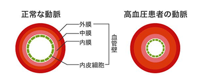 年齢による血圧の変化