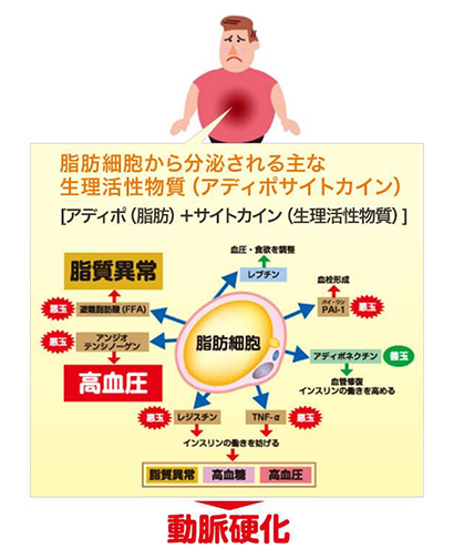 内臓脂肪の蓄積が分泌物質を乱し、メタボリックシンドロームといった生活習慣病の原因となる