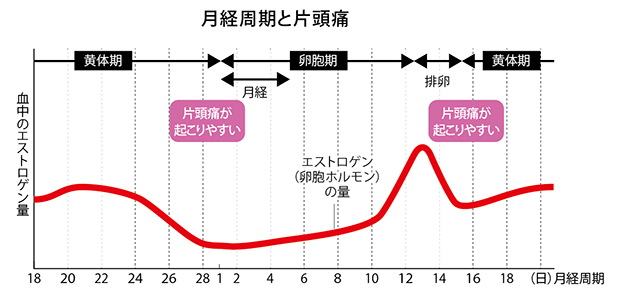 片頭痛が起こりやすいタイミングはいつ？