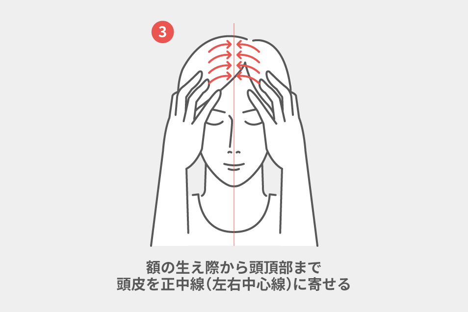 ＜頭皮マッサージ：ステップ３＞ 額の生え際に５本指を置き、頭皮を正中線に寄せる。そのまま指を少しずつ後ろにずらしていき、頭頂部まで４か所を同様に寄せる