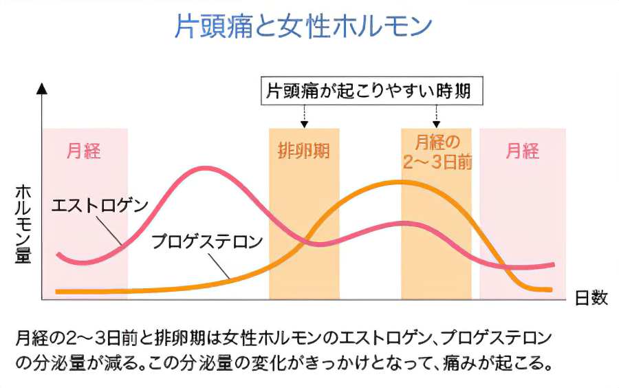 「片頭痛」は、生理周期と密接に関係