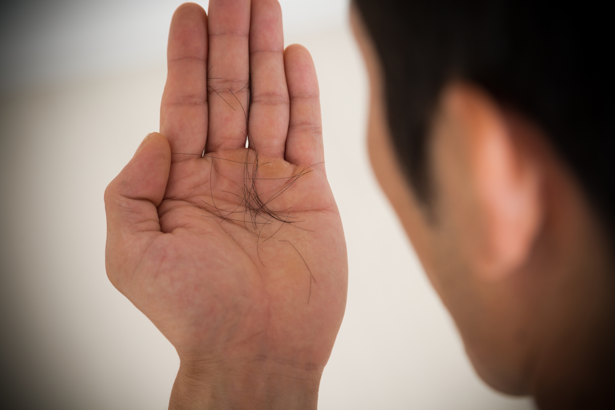 男性の薄毛の原因は、髪が「抜ける」「細くなる」「新たに生えなくなる」から。抜けた髪を見る男性の写真