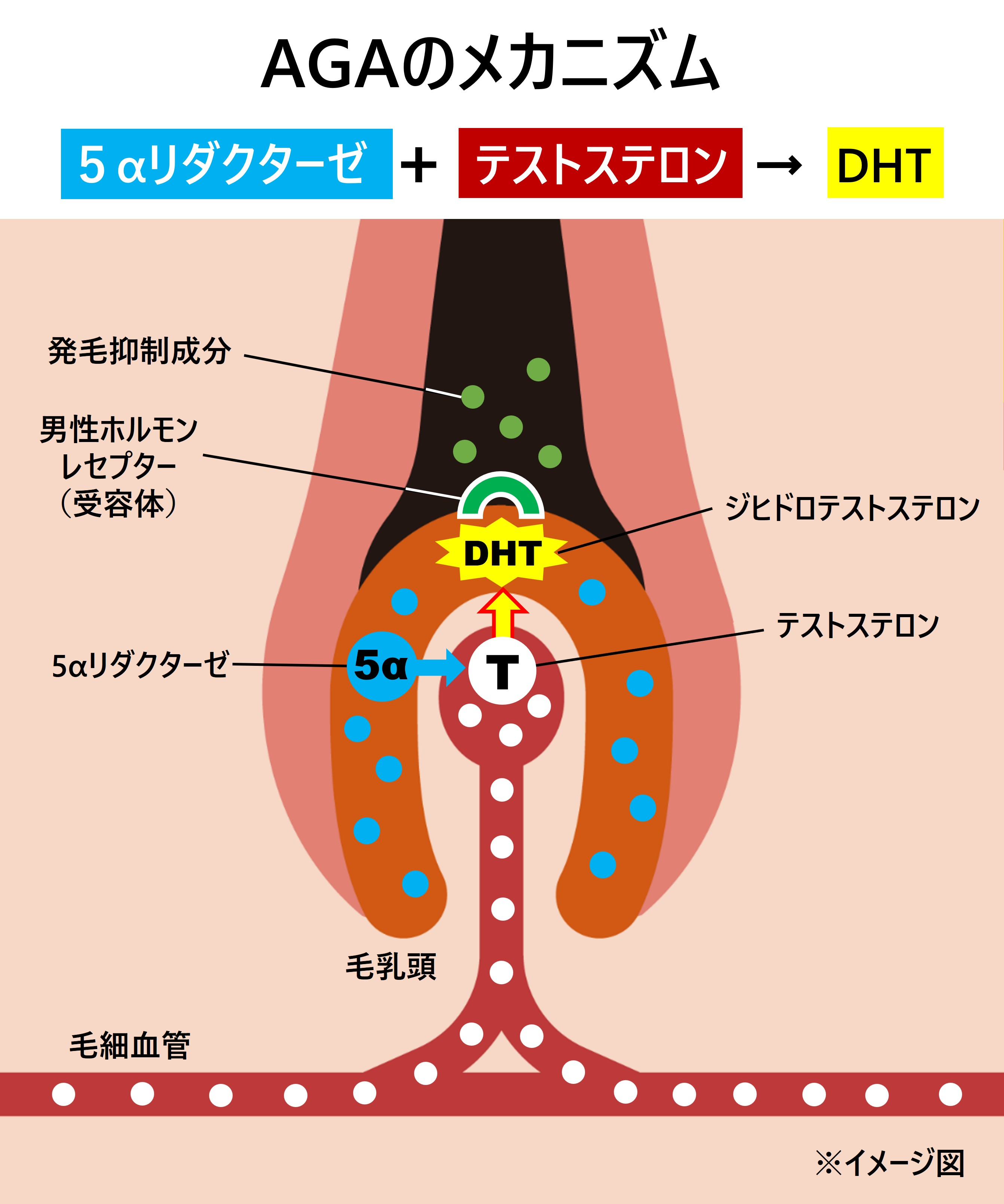 テストステロンは、「5αリダクターゼ」という酵素によって、AGAの原因物質「ジヒドロテストステロン（DHT）」に変換される。男性ホルモンのレセプター（受容体）と結合して毛乳頭に作用し、毛の成長期を短くする。AGAのメカニズムについてのイメージ図
