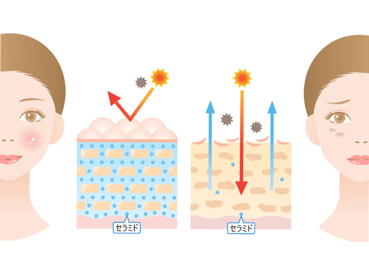 セラミドは50代になると、20代の半分にまで減ってしまうって本当！？