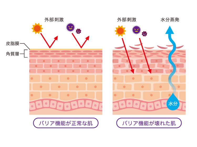 バリア機能が正常な肌　バリア機能が優れた肌