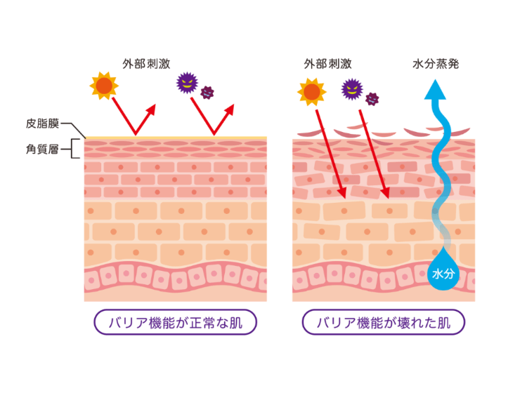 原因１　マスクとの摩擦が刺激となって、肌の“バリア機能”を壊してしまうから