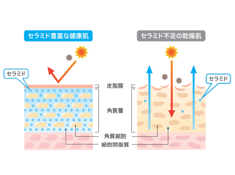 そもそもなぜ「セラミドケア」が必要なの？