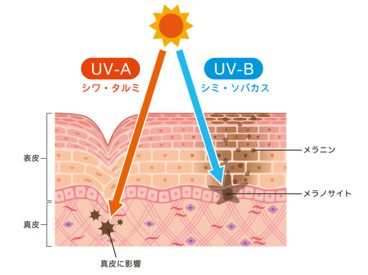 美白の大敵！　外からの刺激「紫外線」には2種類の波長がある