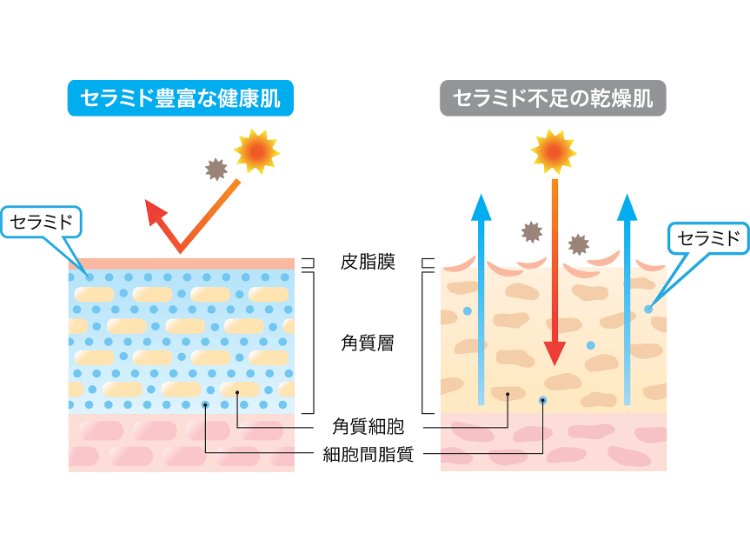 そもそも乾燥肌ってどんな状態？