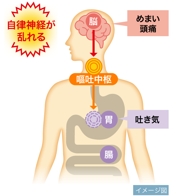 乗り物酔いのメカニズム