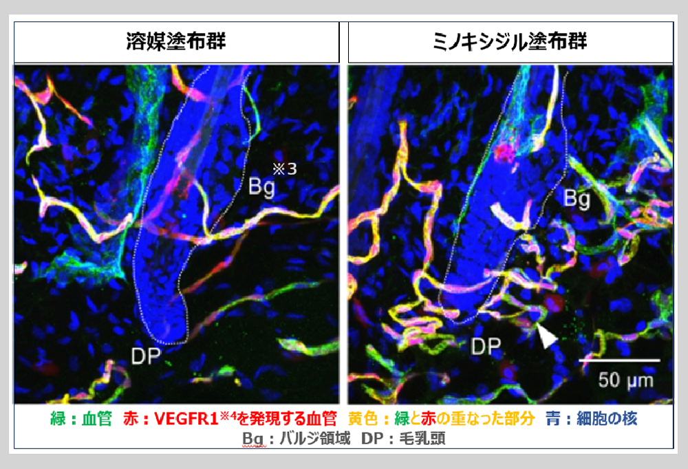 リポビタンDバレンタイン限定ボトルの画像