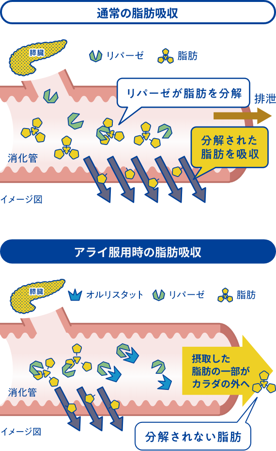 通常の脂肪吸収とアライ服用時の脂肪吸収