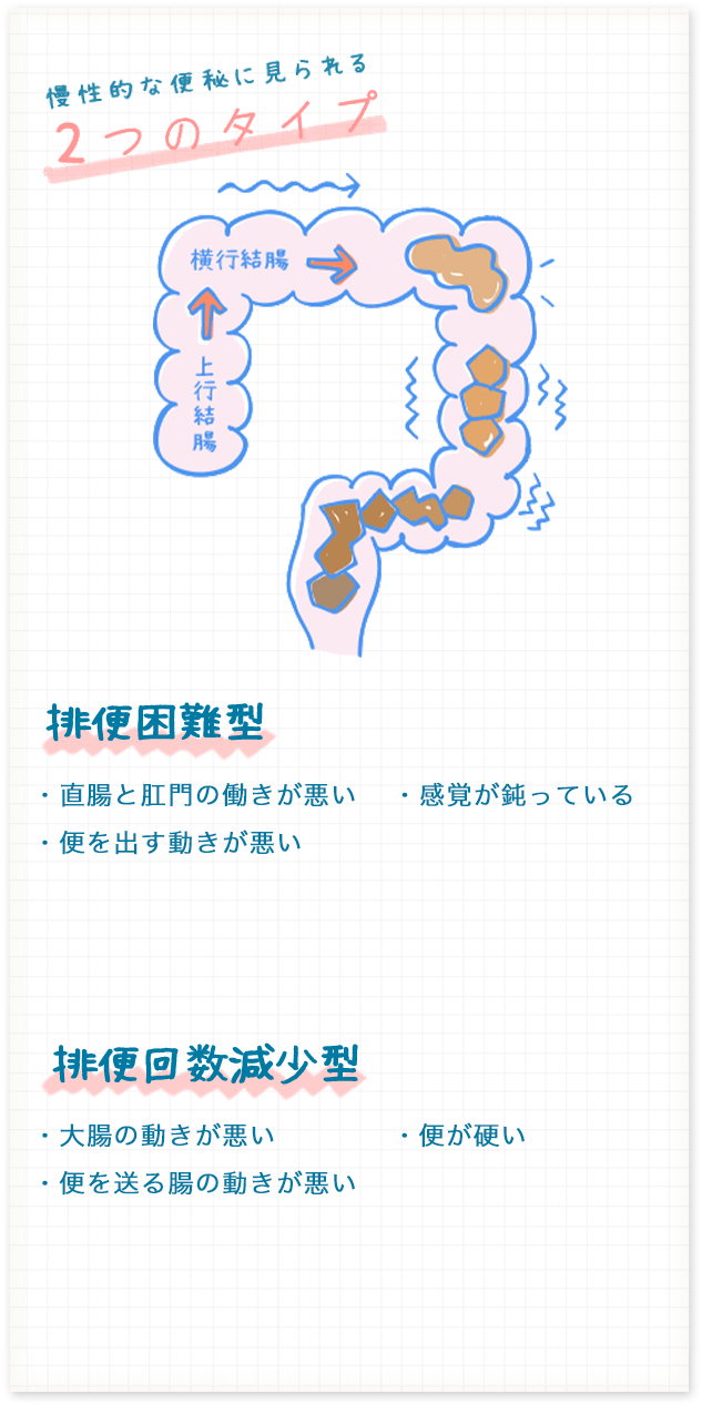 慢性的に便秘に見られる2つのタイプ「排便困難型」、「排便回数減少型」のイメージイラスト