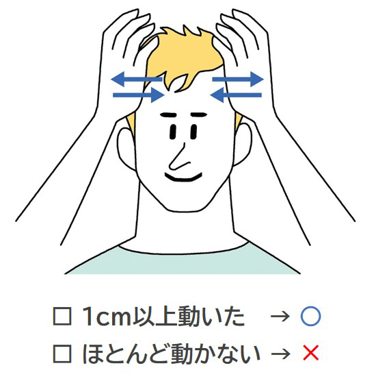 まずは頭皮が動くかどうかチェック