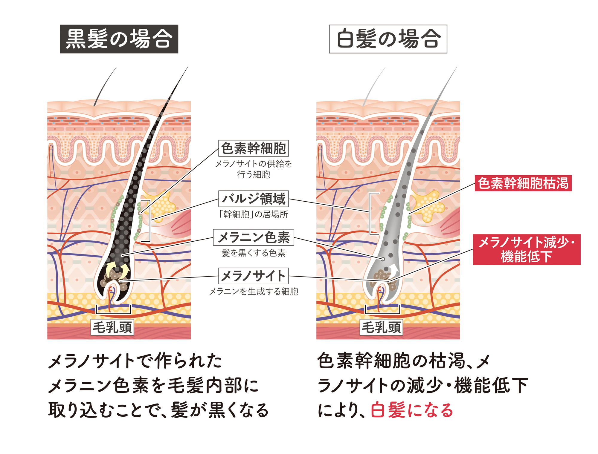 ハーバード大が証明した、白髪とストレスの関係