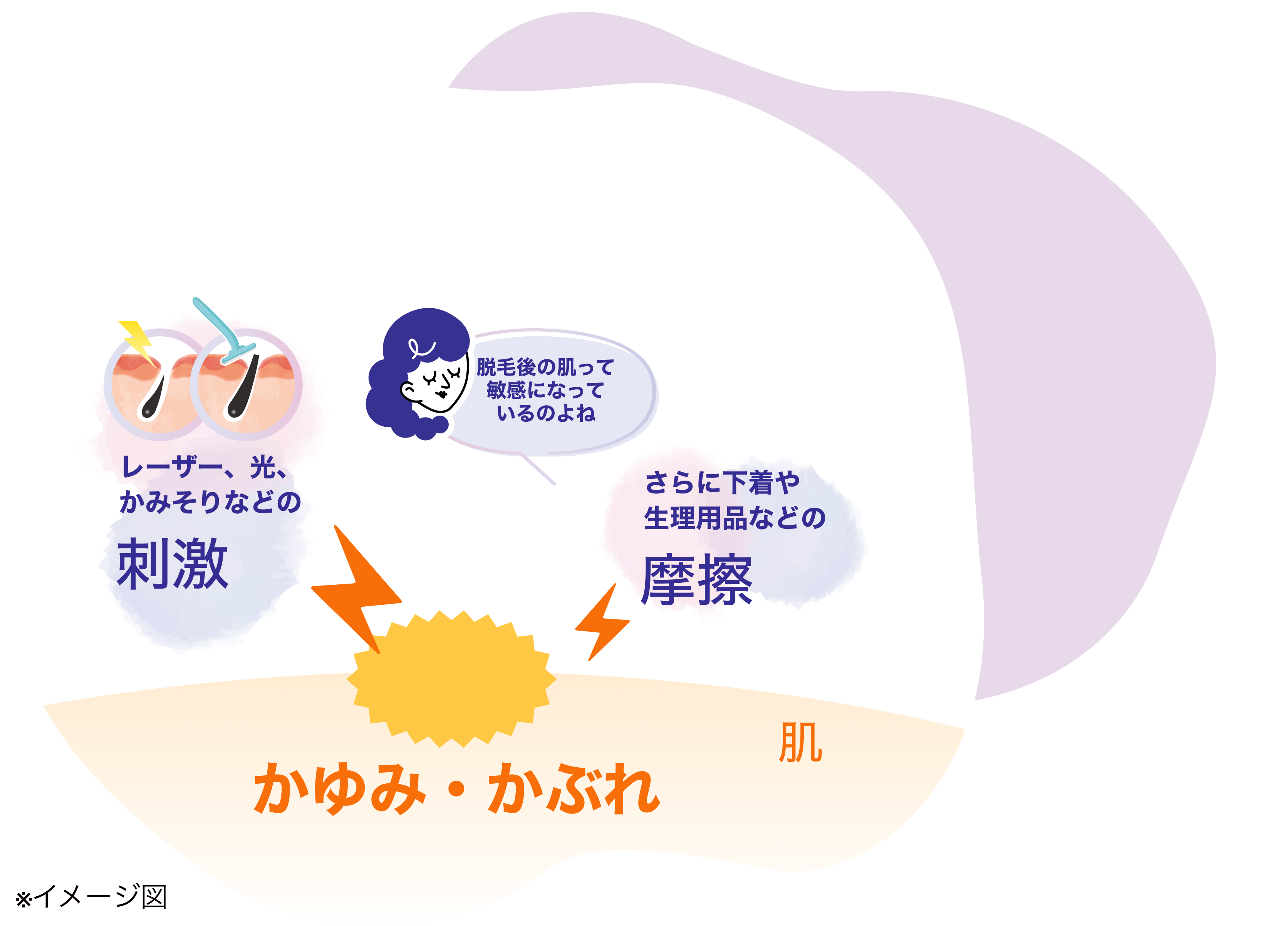 脱毛後の肌のかゆみの原因が記載されているイラスト。レーザー、光、かみそりなどの刺激、下着や生理用品などの摩擦。