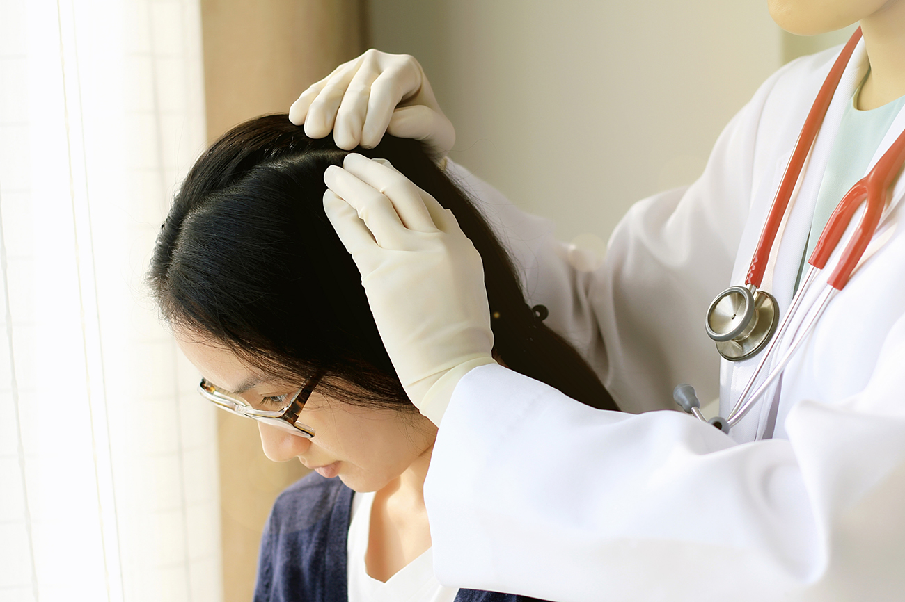 皮脂が過剰分泌し、ベタベタとしたフケも発生し、薄毛が伴えば「脂漏性脱毛症」