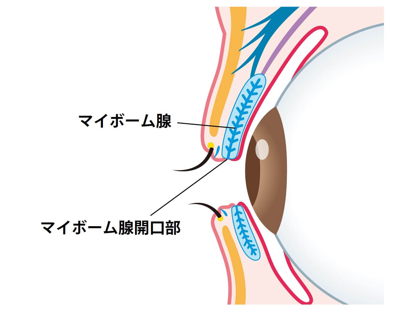 ドライアイの原因：マイボーム腺の詰まり （アイメイクに注意）