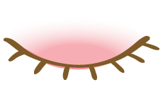 眼瞼炎（まぶたのただれ）のイメージ図
