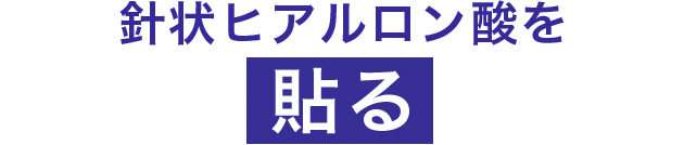 針状ヒアルロン酸を貼る