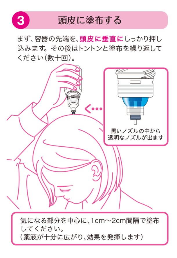 頭皮に塗布する。まず、容器の先端を頭皮に垂直にしっかり押し込みます。その後はトントンと塗布を繰り返してください（数十回）。黒いノズルの中から透明なノズルが出ます。気になる部分を中心に1cm～2cm間隔で塗布してください。（薬液が十分に広がり、効果を発揮します）