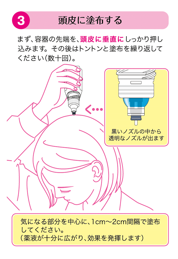 頭皮に塗布する。まず、容器の先端を頭皮に垂直にしっかり押し込みます。その後はトントンと塗布を繰り返してください（数十回）。黒いノズルの中から透明なノズルが出ます。気になる部分を中心に1cm～2cm間隔で塗布してください。（薬液が十分に広がり、効果を発揮します）