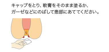 肛門外側に使用する場合は、キャップをとり、軟膏をそのまま塗るか、ガーゼなどにのばして患部にあててください。