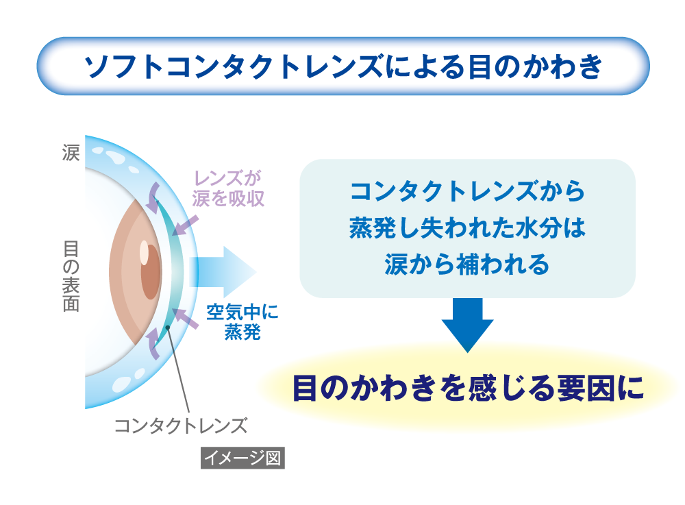 ソフトコンタクトレンズによる目の乾き