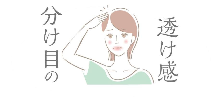 分け目の透け感を悩む女性のイラスト