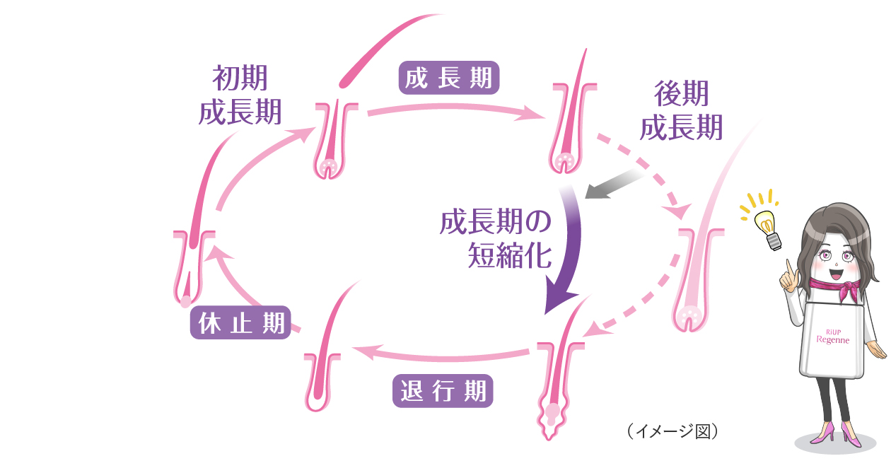 壮年性脱毛症、ボリュームダウンしている髪のヘアサイクルのイメージ図。壮年性脱毛症では成長期が短縮化する