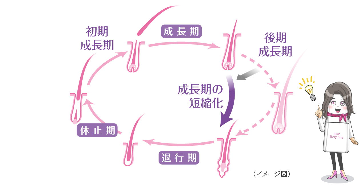 壮年性脱毛症のヘアサイクルのイメージ図　壮年性脱毛症では成長期が短縮化する