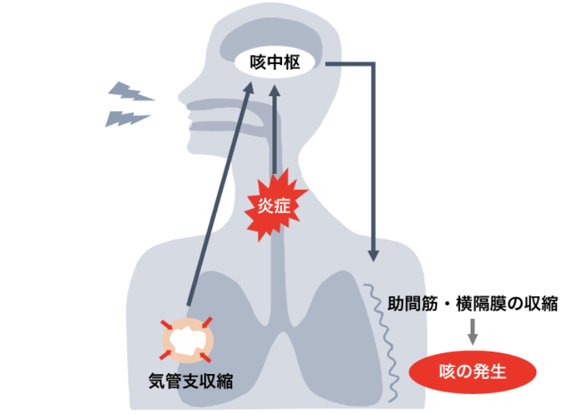 せきは気道の炎症や気管支の収縮によって 咳中枢に刺激が伝わり、咳反射となって起こるといったメカニズムを記したイメージイラスト