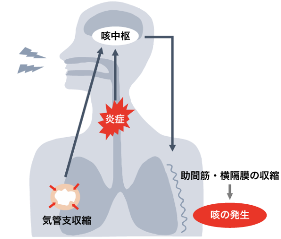 せきは気道の炎症や気管支の収縮によって 咳中枢に刺激が伝わり、咳反射となって起こるといったメカニズムを記したイメージイラスト