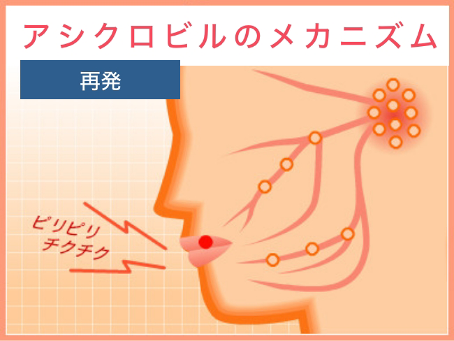 アシクロビルのメカニズム 再発