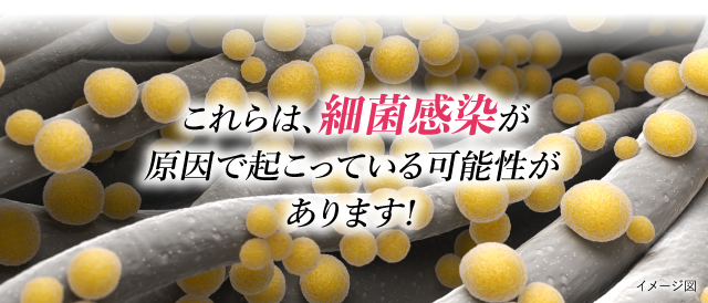 これらは細菌感染が原因で起こっている可能性があります
