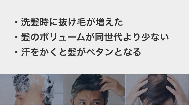 髪のお悩み　・洗髪時に抜け毛が増えた ・髪のボリュームが同世代より少ない ・汗をかくと髪がペタンとなる