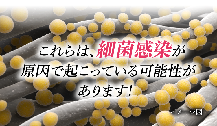 これらは細菌感染が原因で起こっている可能性があります